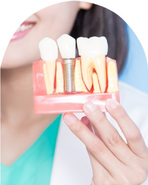 Dental Implants - Bell Family Dental in Bayside, NY Dental Implants - Bell Family Dental in Bayside, NY